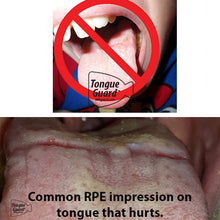 Load image into Gallery viewer, RPE Tongue Guard