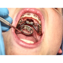 Load image into Gallery viewer, RPE Tongue Guard