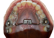 Load image into Gallery viewer, RPE Tongue Guard