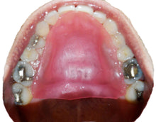 Load image into Gallery viewer, RPE Tongue Guard